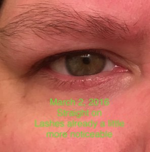 Eyelashes after using Revitalash Advanced eyelash conditioner 993