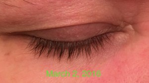 Eyelashes after using Revitalash Advanced eyelash conditioner 0998